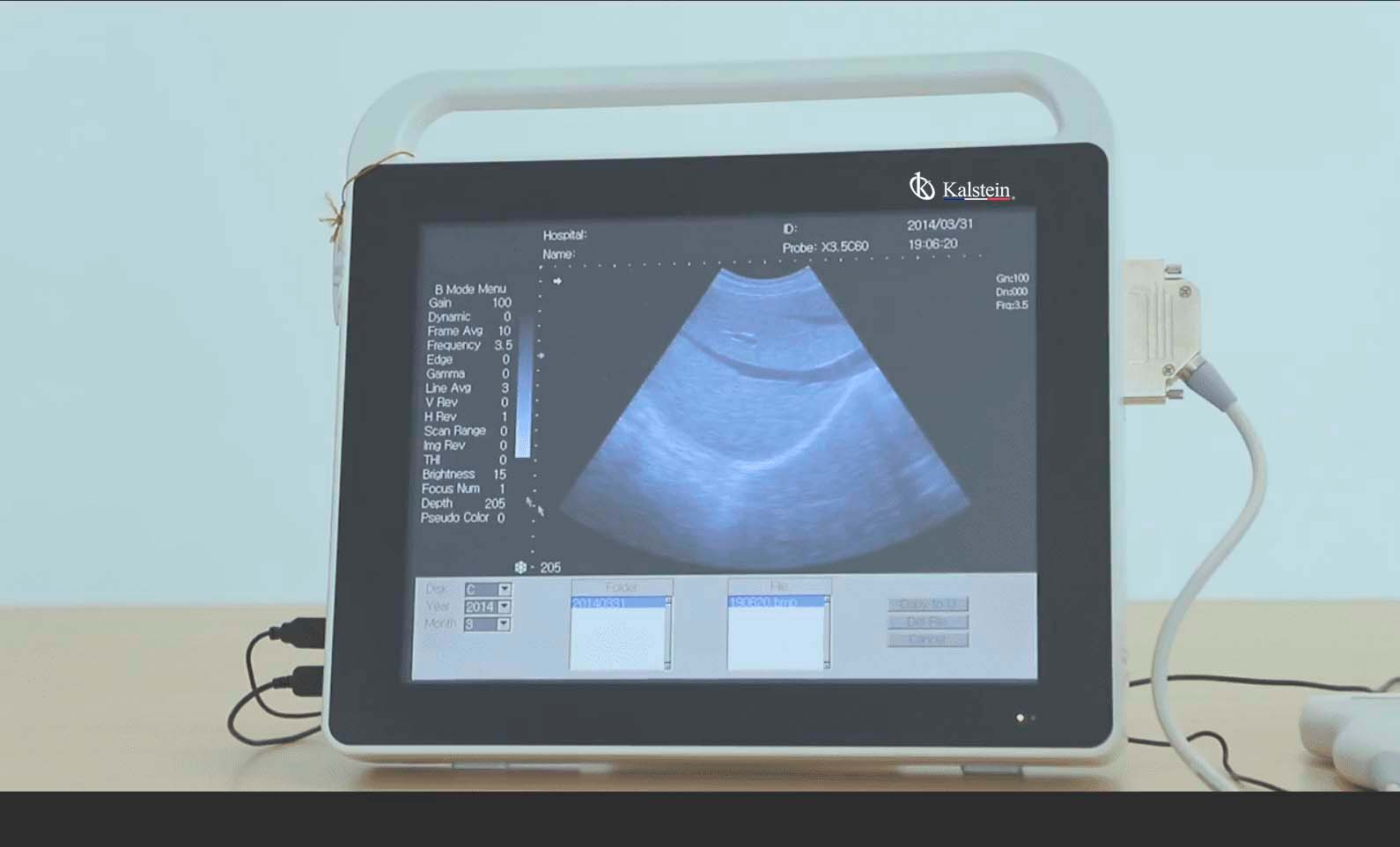 The Future of Diagnostic Imaging: Unearthing the Potential of the Ultrasound Scanner