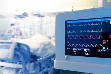 What are the criteria for selecting an ideal patient monitor?