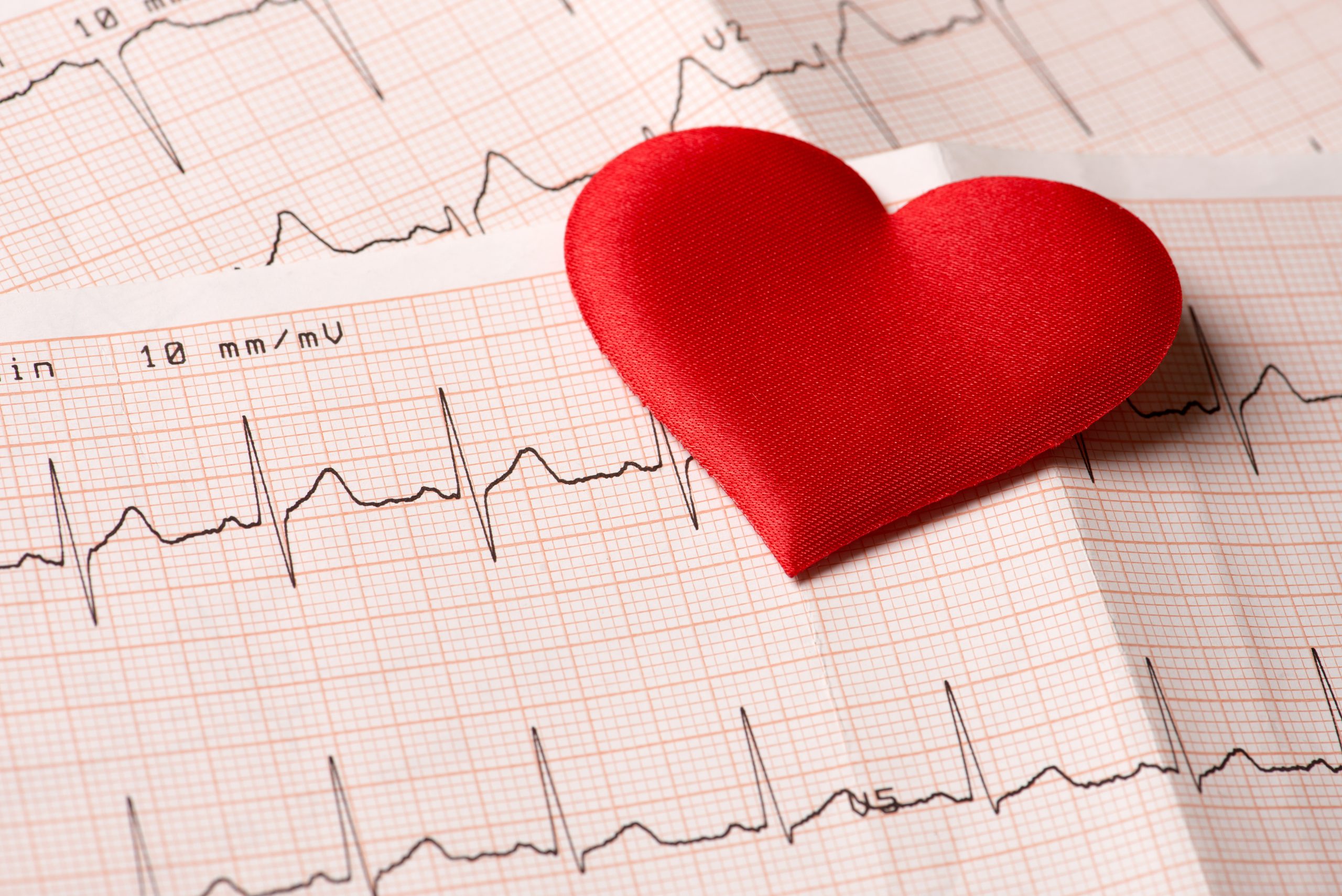 How is an ECG interpreted?