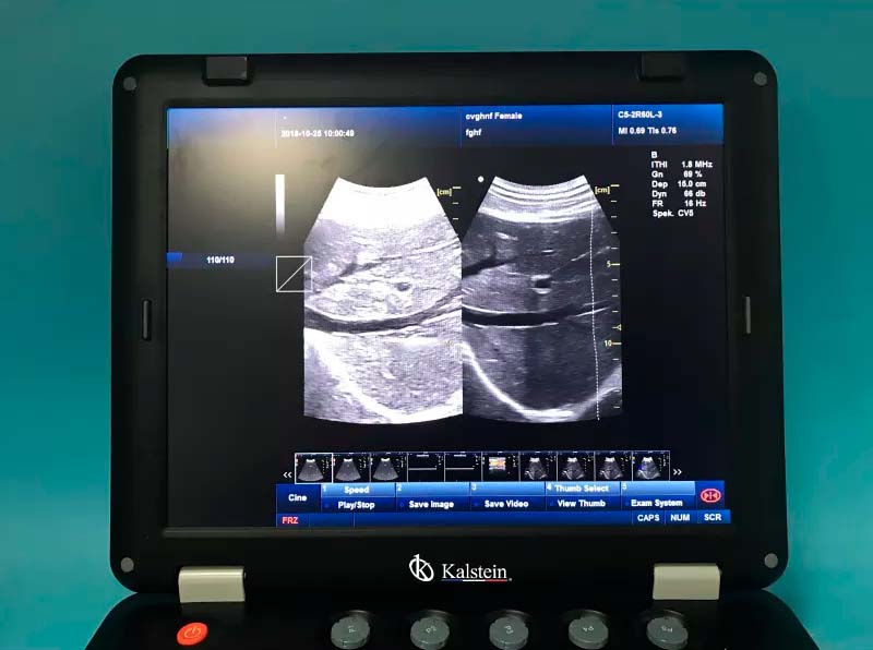 Discovering the Power and Versatility of Ultrasound Scanners by Kalstein