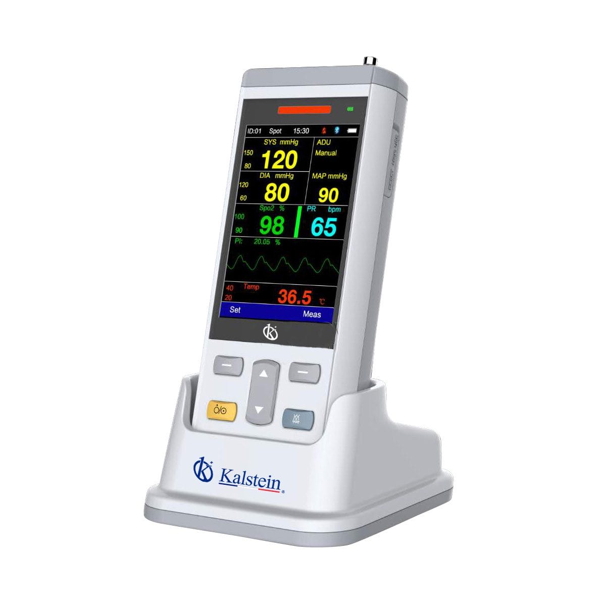 Comparison of Veterinary Handheld Vital Sign Monitors: Kalstein YR06106 vs. Zoetis VetScan VS2